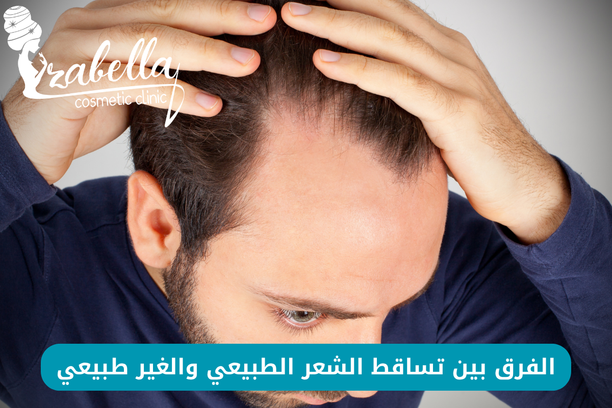 متي يكون تساقط الشعر خطير ومتي يكون طبيعي